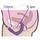 Rocks Off 7 Speed Vibrating Rock Chick G-Spot and Clitoral Vibrator