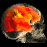 Female Orgasm in Brodmann Brain Regions - The Visual MD